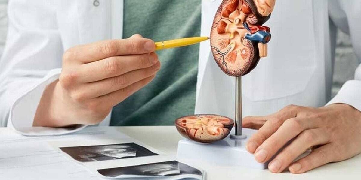 بهترین روش درمان سنگ کلیه