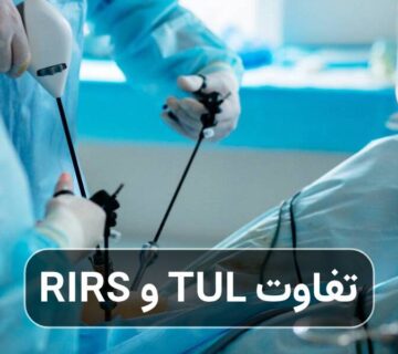تفاوت TUL و RIRS