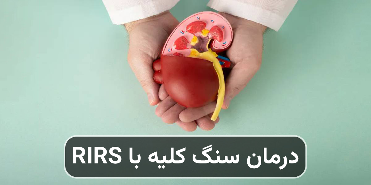 درمان سنگ کلیه با RIRS