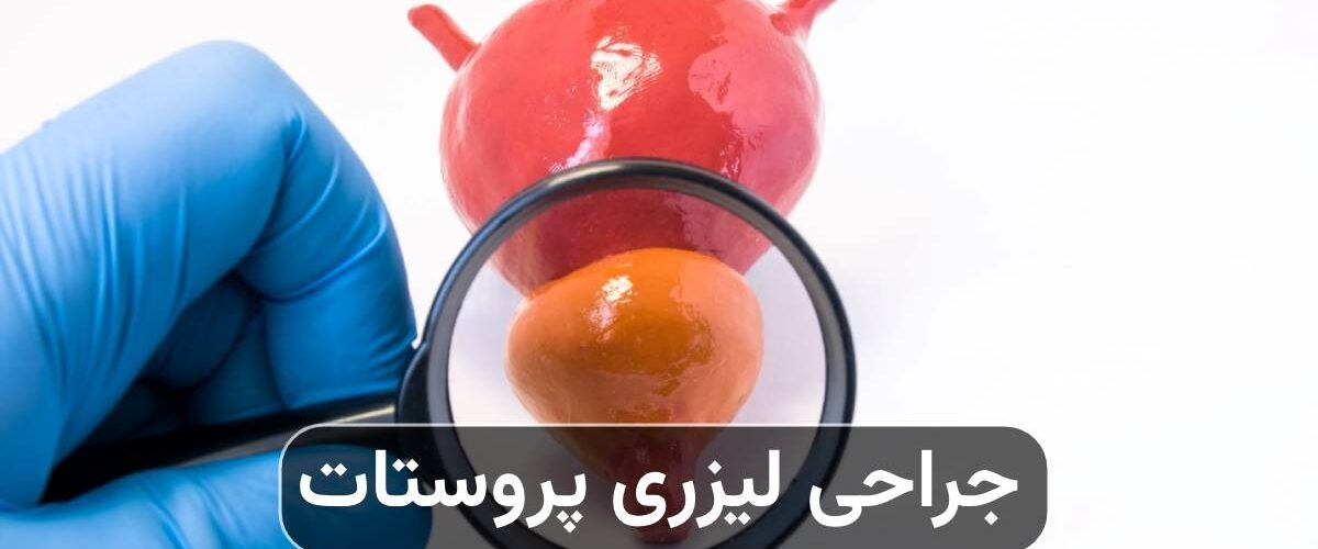 جراحی لیزری پروستات