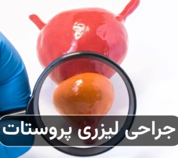 جراحی لیزری پروستات