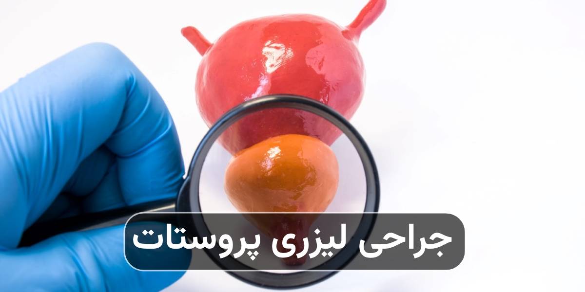 جراحی لیزری پروستات
